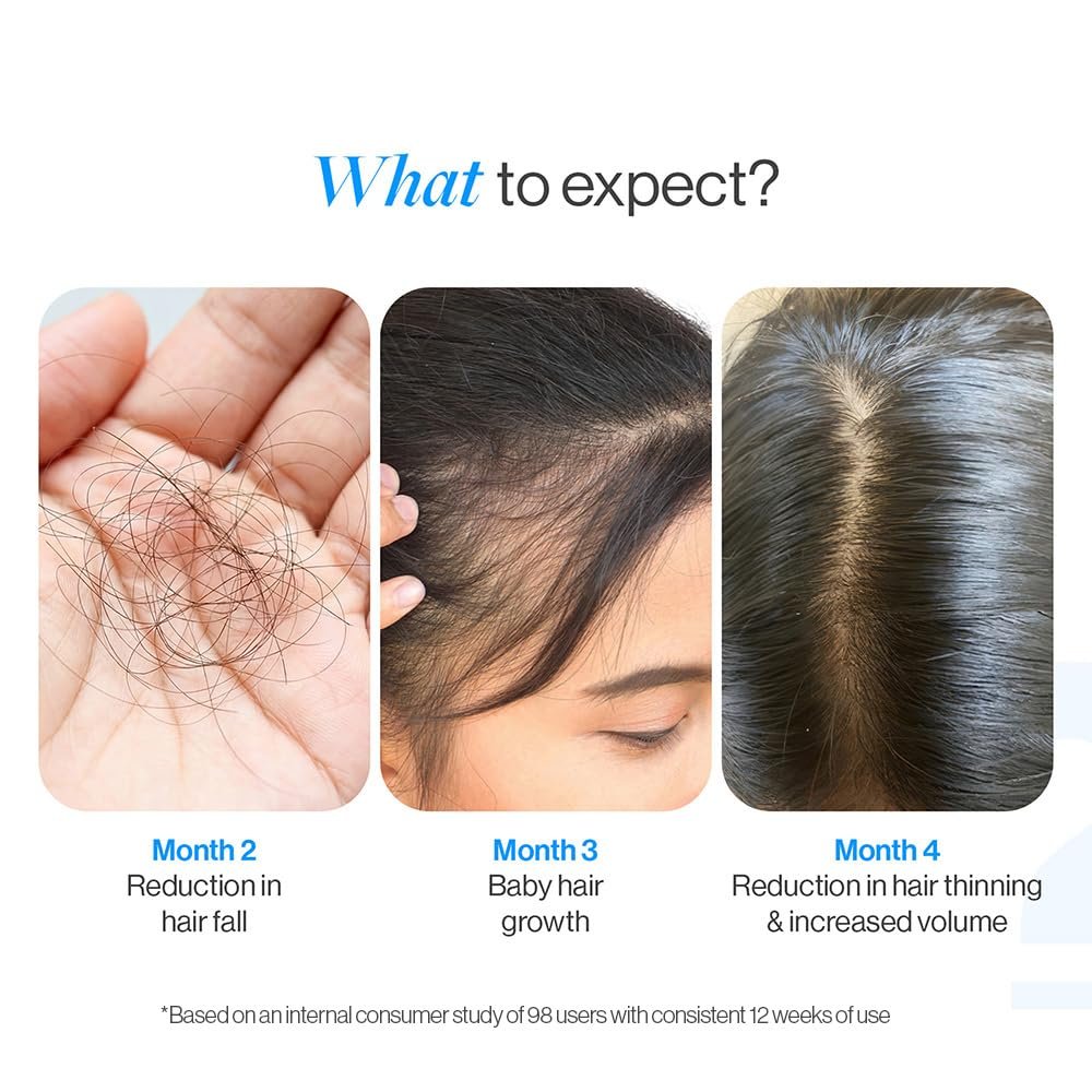 best-roll-on-hair-growth-serum